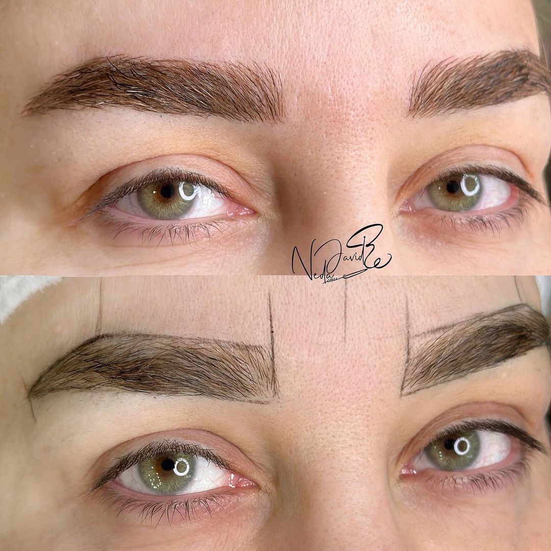 میکروبلیدینگ